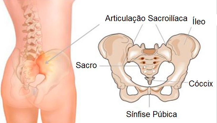 Artrose: saiba como desemperrar de vez